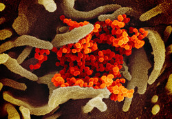 03 13 corona virus