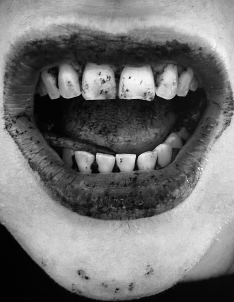 11 19 denti